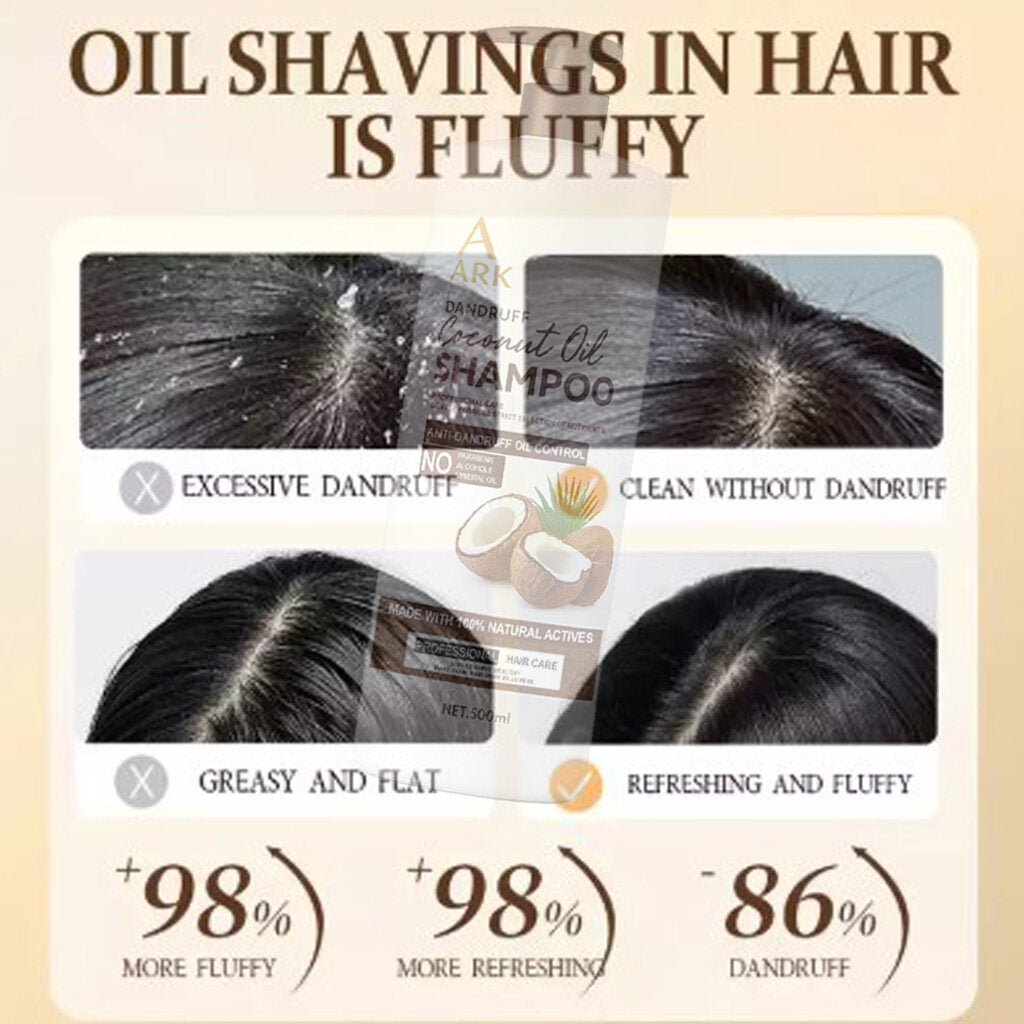 ARK Coconut Oil Nourishing Shampoo 500ml | Anti-Dandruff, Moisturizing & Smoothing