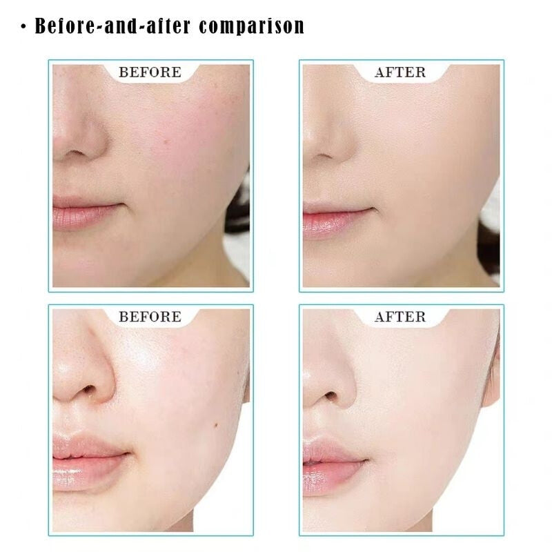 5in1 Skincare Gel Set – Pomegranate, Vitamin C, Aloe Vera, Snail & Moisturizer | Sadoer + Bioaqua + Lifusha