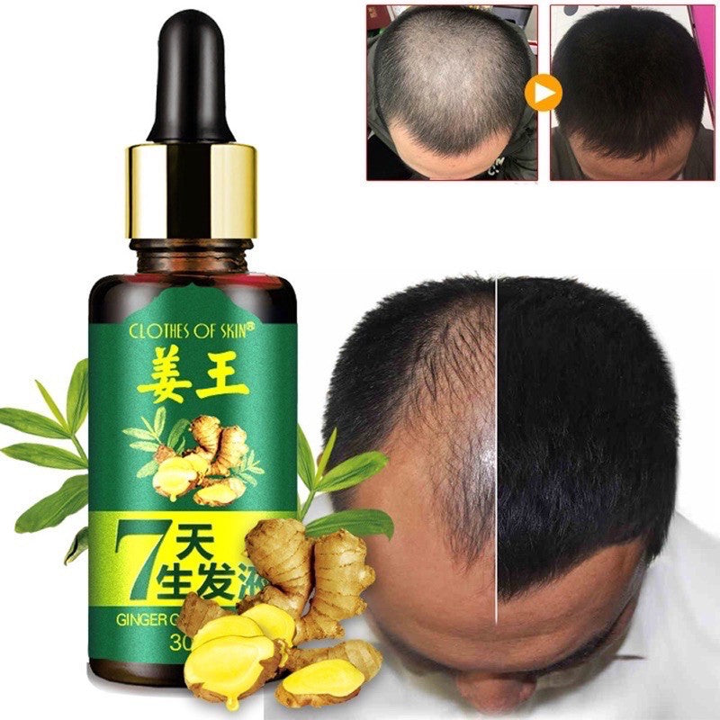 Ginger King Germinal Oil Hair Growth Serum 30ml