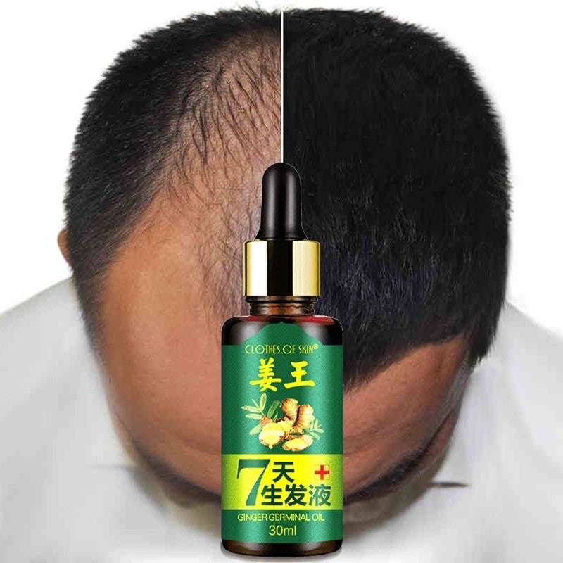 Ginger King Germinal Oil Hair Growth Serum 30ml