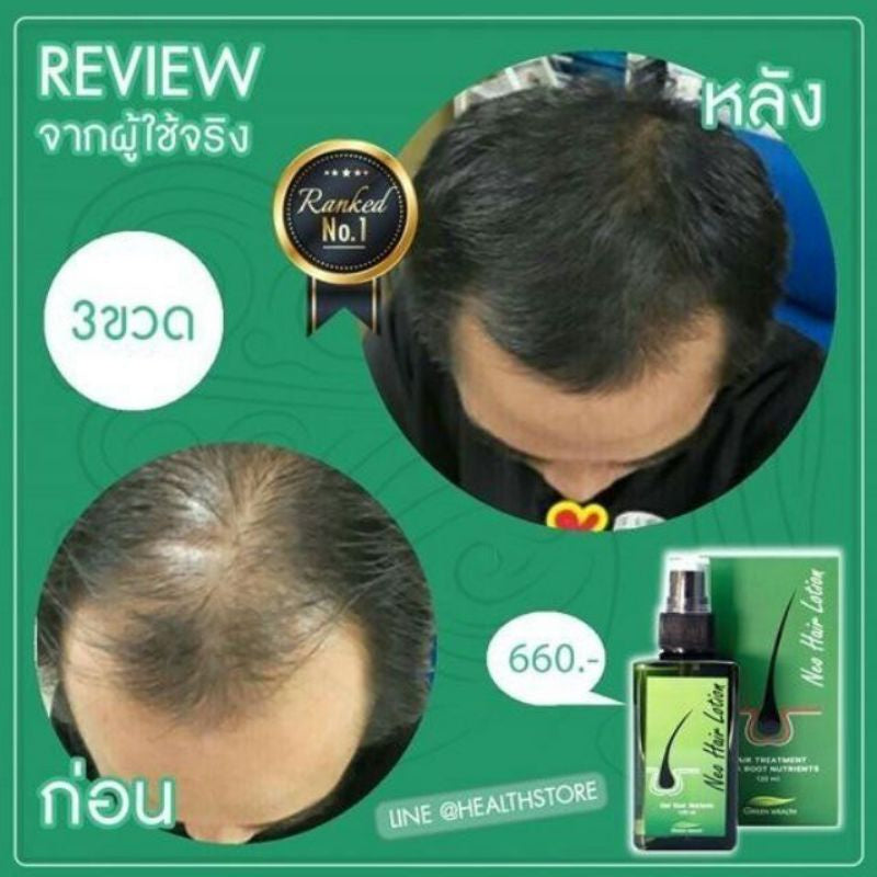Neo Hair Lotion 120ml New Formula