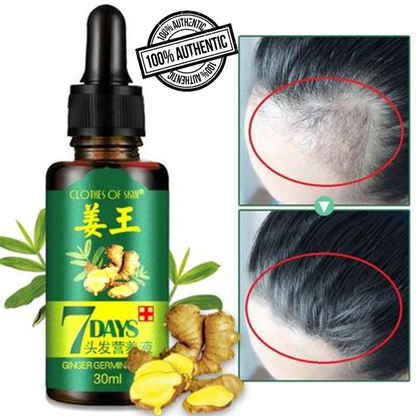 Ginger King Germinal Oil Hair Growth Serum 30ml