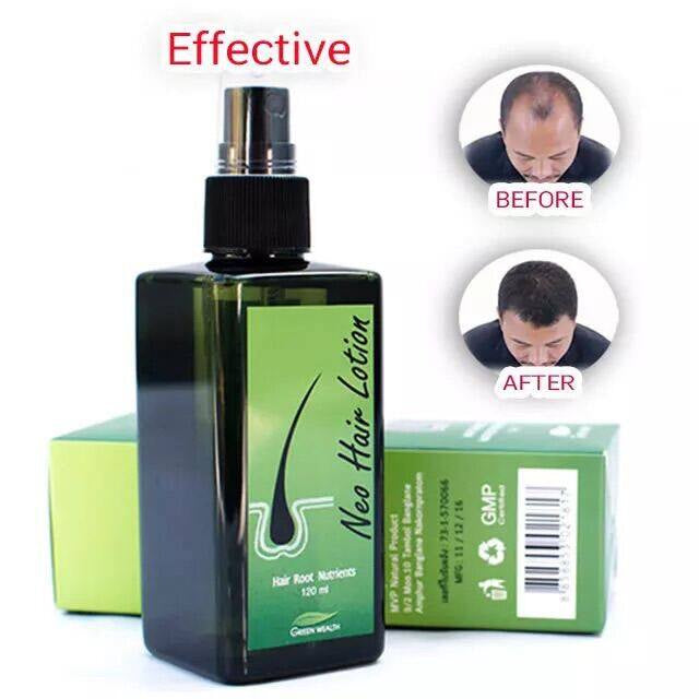 NEO Hair Lotion Spray Hair Loss Treatment