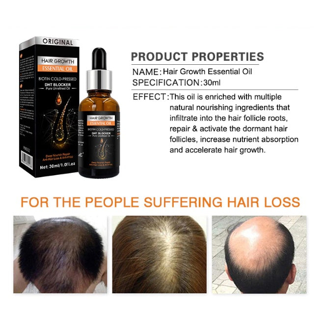 Ginger Hair Growth Essential Oils Hair Regrowth Serum