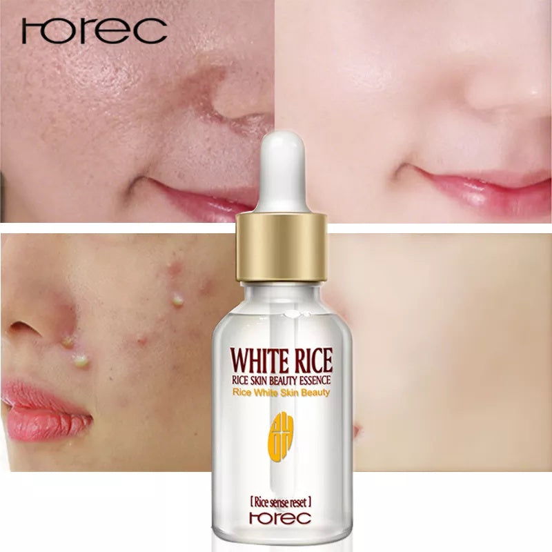 Rorec Moisturizing Essence Whitening Serum