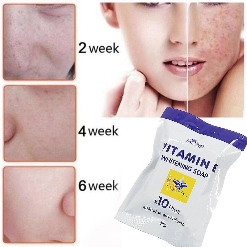 Vitamin E Whitening Soap X10 for Dark Spots