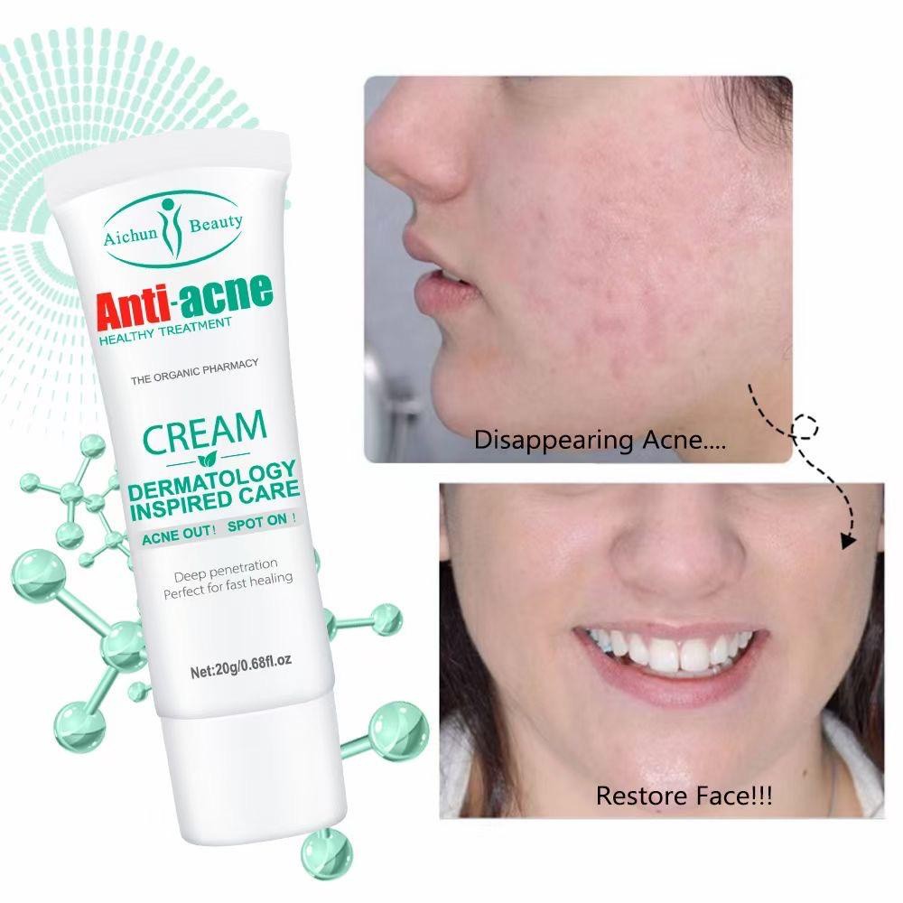 Aichun Anti-Acne Pimple Removal Cream