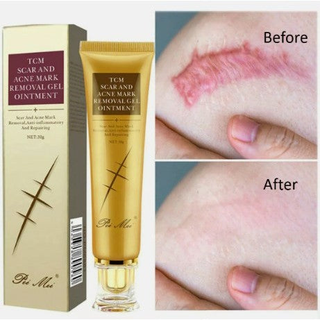 PEI MEI TCM Scar & Acne Mark Gel 30ml