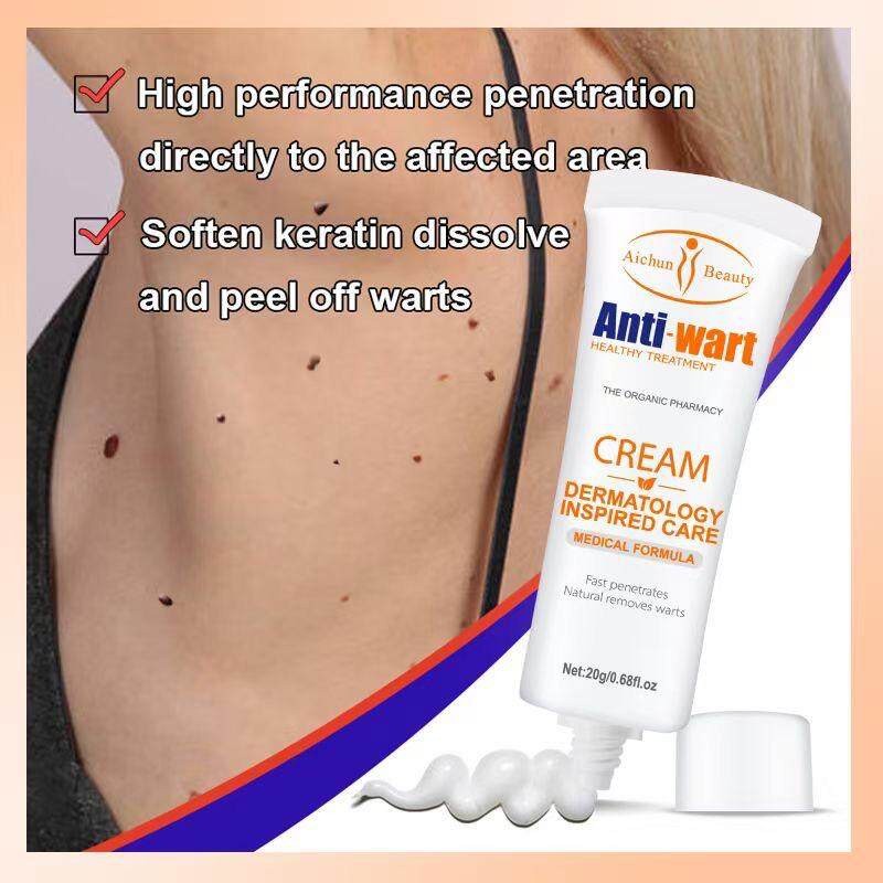 Aichun Beauty Wart Removal Cream 1 Week
