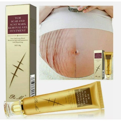 PEI MEI TCM Scar & Acne Mark Gel 30ml