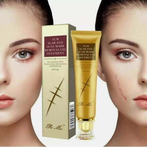 PEI MEI TCM Scar & Acne Mark Gel 30ml
