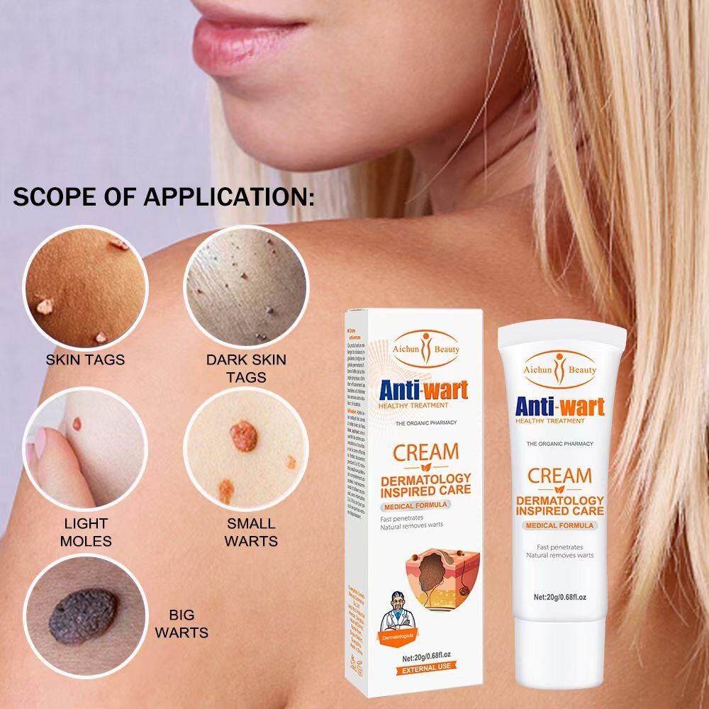 Aichun Beauty Wart Removal Cream 1 Week