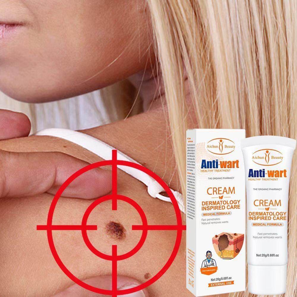 Aichun Beauty Wart Removal Cream 1 Week