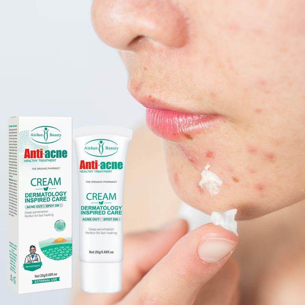 Aichun Anti-Acne Pimple Removal Cream
