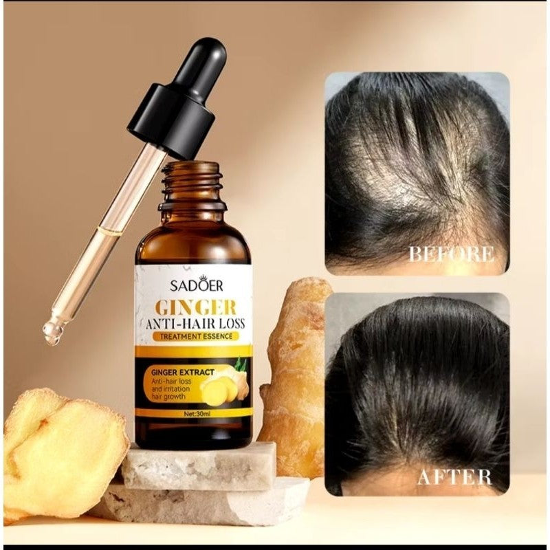 SADOER Ginger Hair Loss Serum