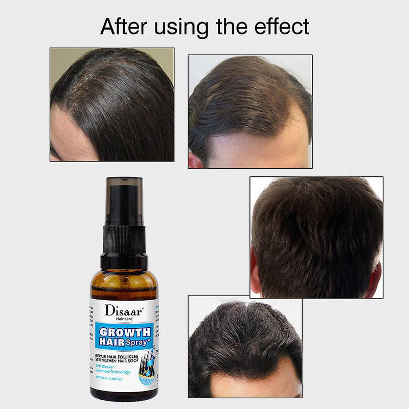 Disaar Hair Growth Accelerator Spray