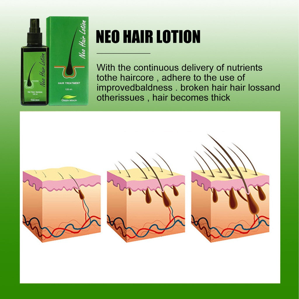 Neo Hair Lotion 120ml + Gift Roller