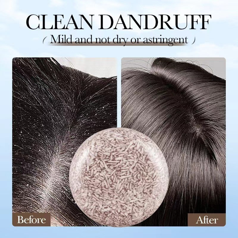 SADOER Polygonum Dandruff Soap