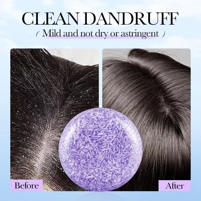 SADOER Lavender Soap for Dandruff Control