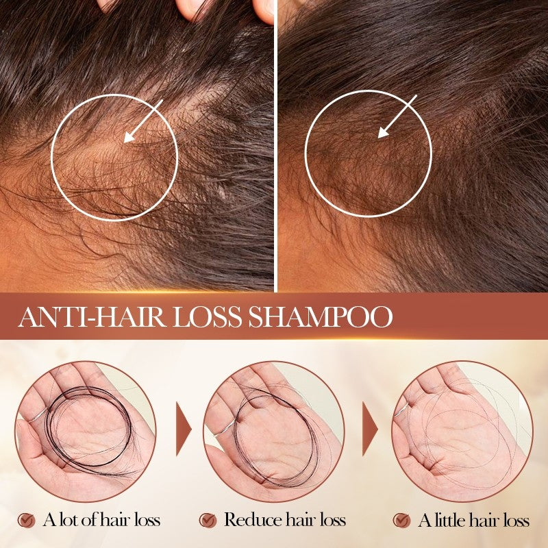 Sadoer Cocoa Butter Shampoo 400ml Anti Hair Loss