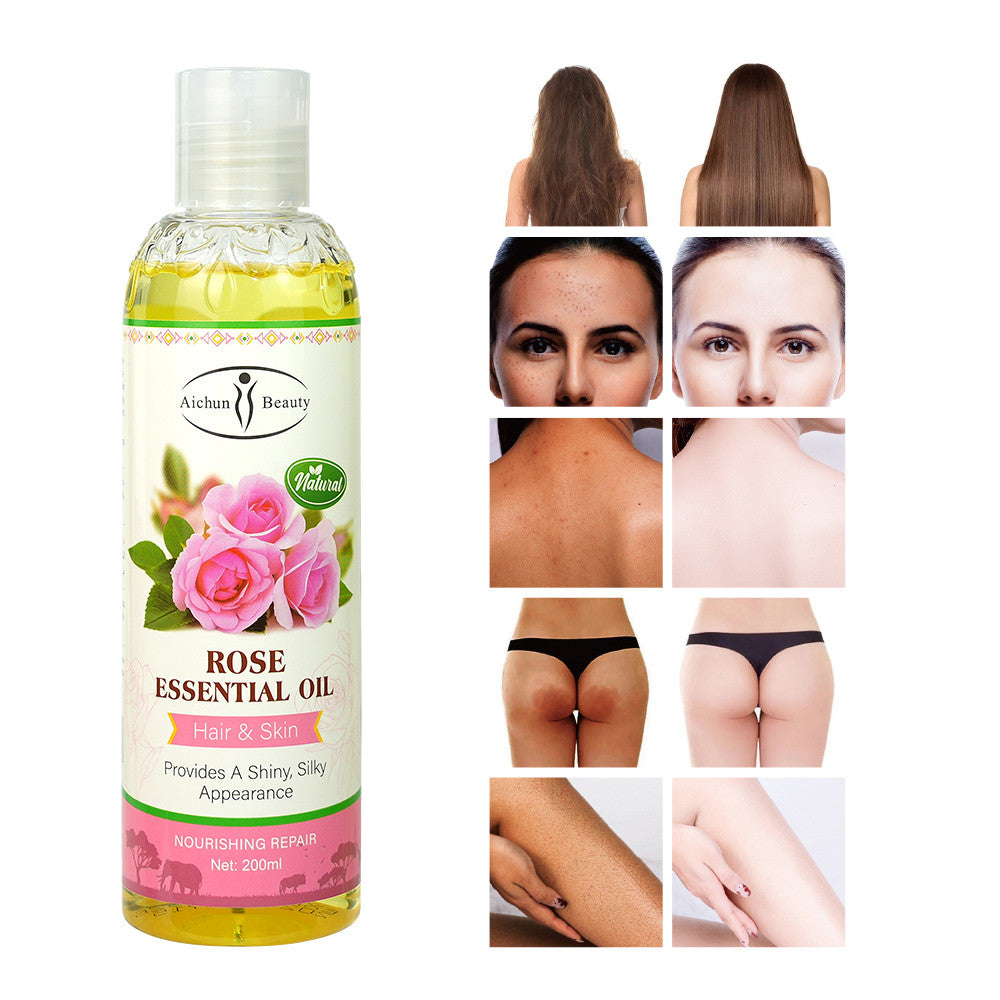 Aichun Pure Rose Essential Oil for Skin