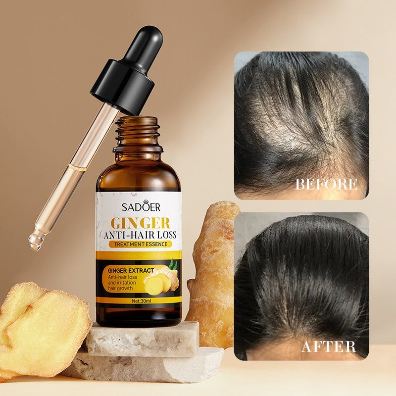 Sadoer Ginger Serum 30ml Hair Growth Essence